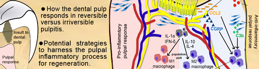 The role of inflammation modulation in dental pulp regeneration